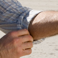 Surgical scars from dialysis